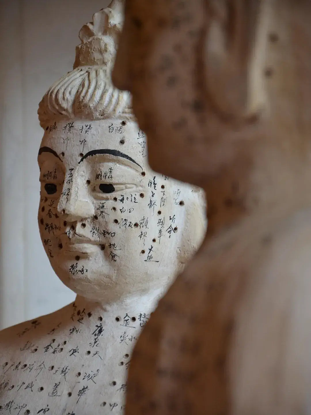 TCM practitioner performing acupuncture treatment, close-up of back points and thin needles